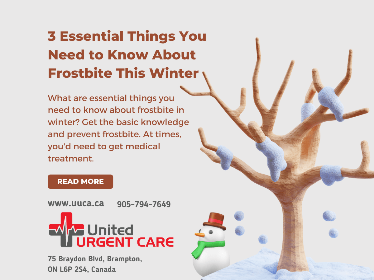 Featured image for “3 Essential Things You Need to Know About Frostbite This Winter”